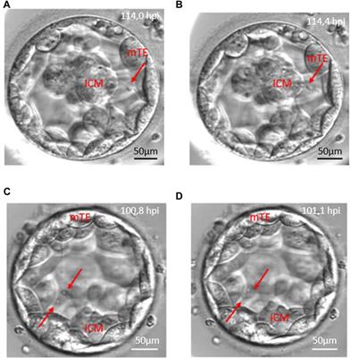 The importance of cytoplasmic strings during early human embryonic development